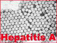 Green Onions Likely Cause of Hepatitis
